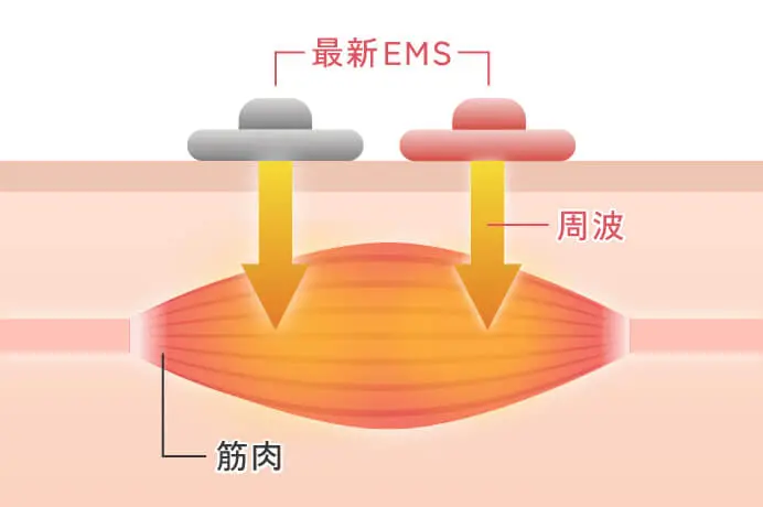 EMSがどのようにして筋肉に刺激を与えるかの図になります